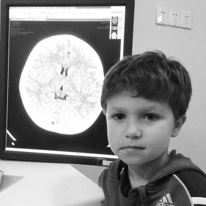 Luke with his brain.